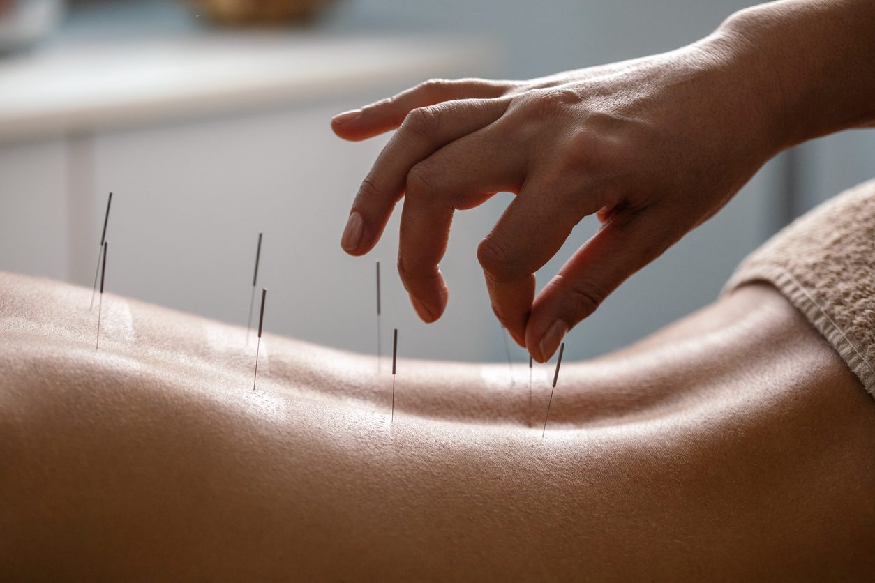 The Ancient Wisdom of Acupuncture: Empowering Women’s Health