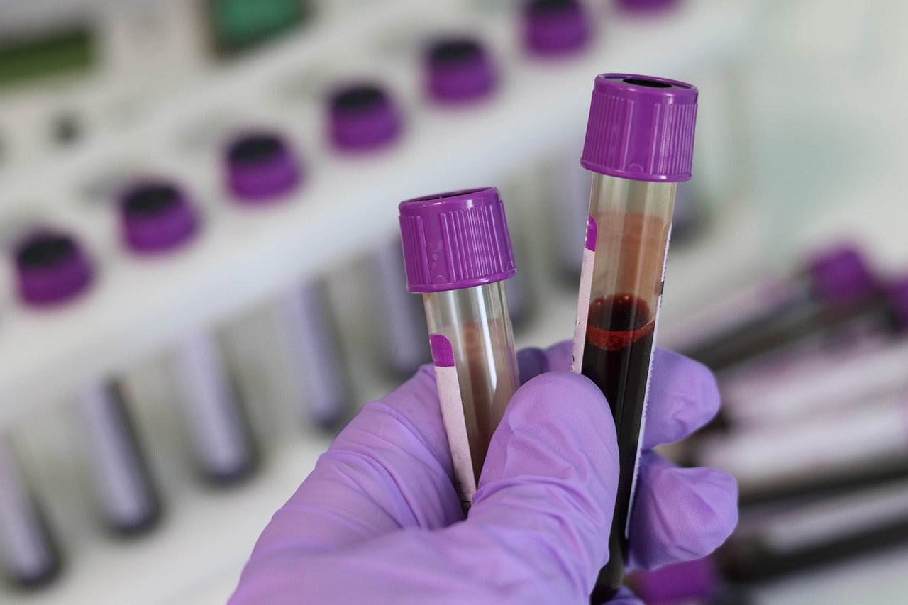 Essential Blood Tests for Understanding Menstrual Health