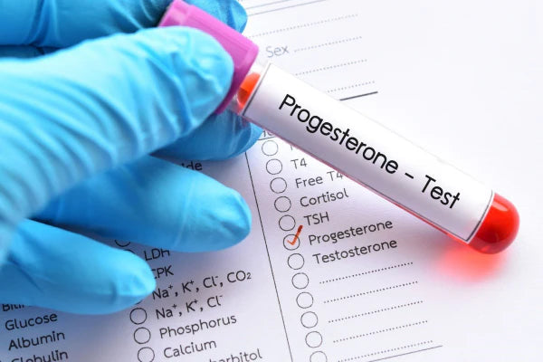The Problem With A Day 21 Progesterone Tests